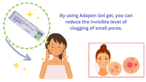 By using Adapen Gel gel, you can reduce the invisible level of clogging of small pores.